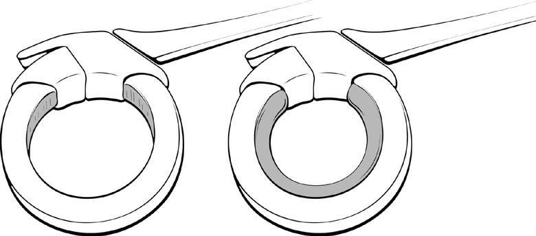 Surgical procedure illustration